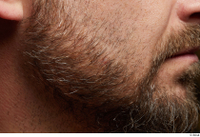  HD Face Skin Neeo bearded chin face skin pores skin texture 0001.jpg